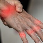 The symptoms of tingling, numbness, weakness, or pain of the fingers and wrist